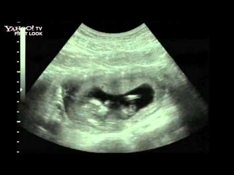 Beyoncé: Life Is But a Dream Trailer