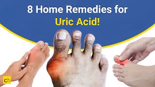 Best 8 Home Remedies for Gout or Uric Acid - Credihealth