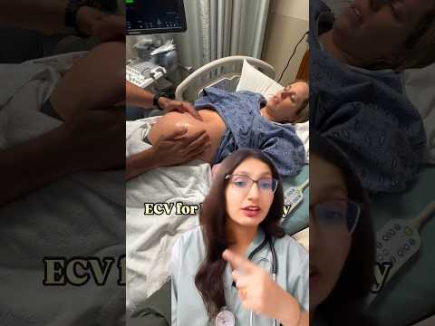 ECV( external cephalic version) #shorts #viral #medical
