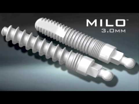 download lagu mp3 mp4 Milo Implants, download lagu Milo Implants gratis, unduh video klip Milo Implants