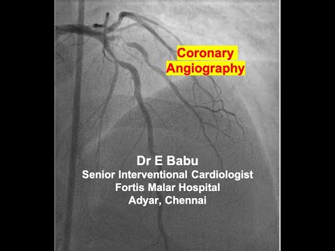 What is Coronary Angiography or Angiogram ?...Dr E Babu Cardiologist, Fortis Malar Hospital, Chennai