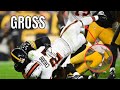 NFL GROSSEST INJURIES