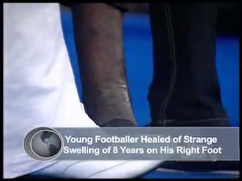 Footballer healed miraculously - 5 Nights of Glory with David Ibiyeomie