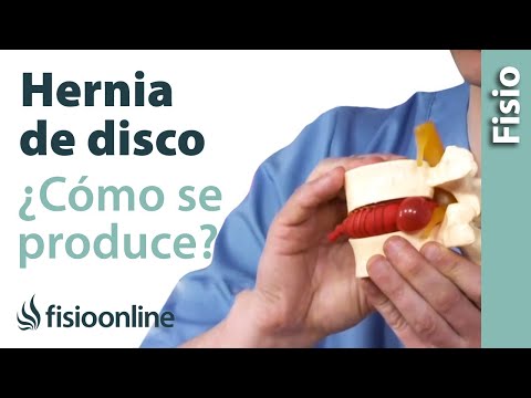 Dolore alle articolazioni kerosene rimedi popolari Trattamento della schiena volare agarico