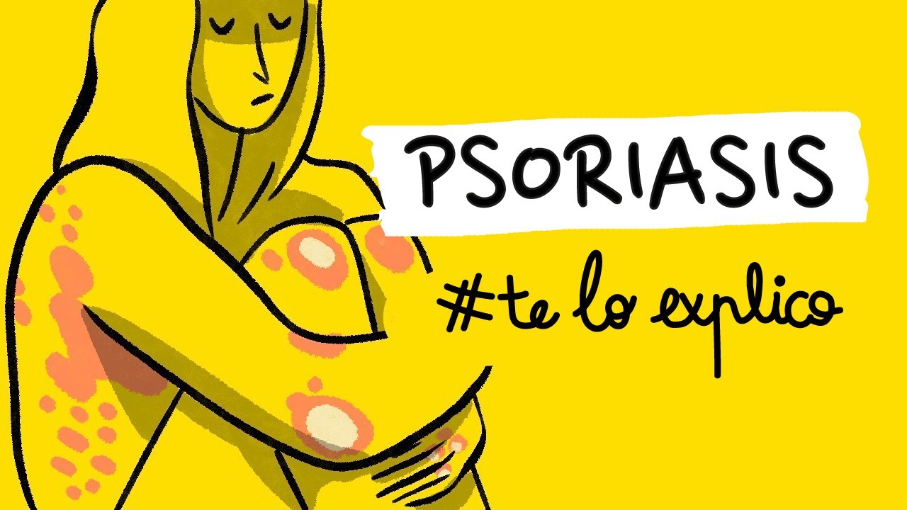QUÉ ES Y CÓMO FUNCIONA LA PSORIASIS | #TELOEXPLICO
