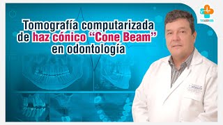 Tomografía computarizada de haz cónico Cone Beam en odontología | Tu Salud Guía