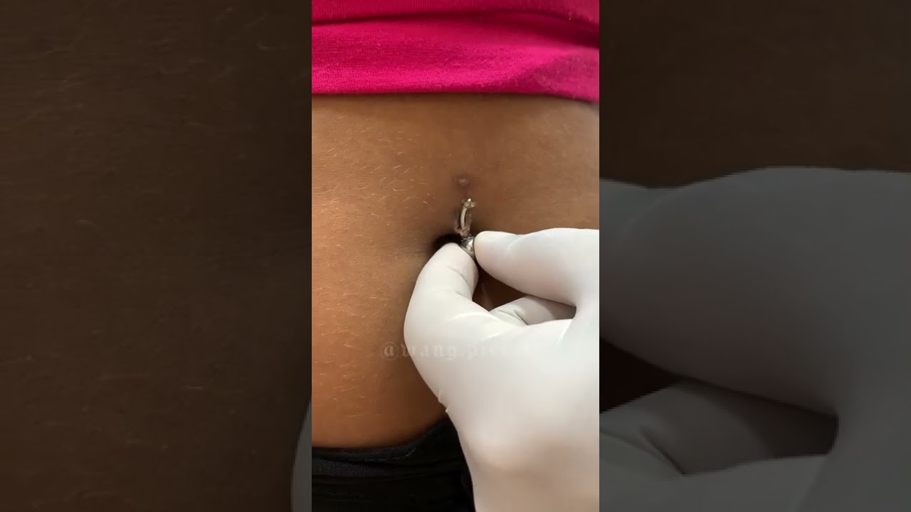 Piercing de Umbigo Expelindo 😱