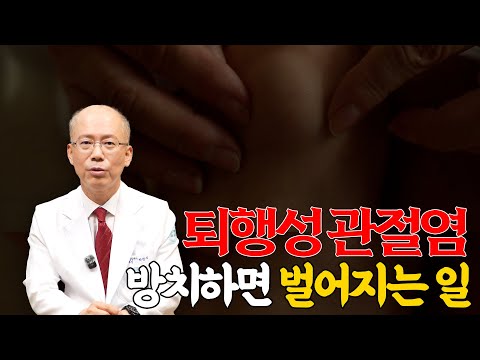 퇴행성 관절염 방치하면 벌어지는 일