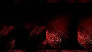 Fetus Heist- A Surgical Demise