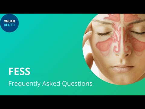FESS- Frequently Asked Questions