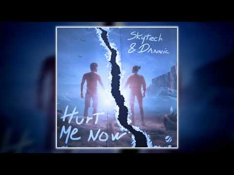 Skytech & Dannic - Hurt Me Now (VLN Remix)