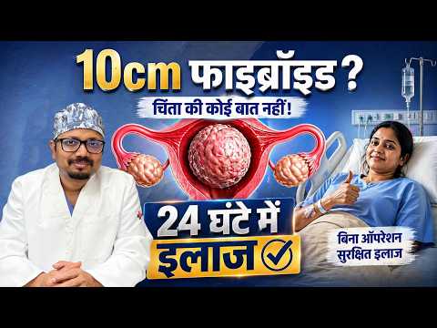 बच्चेदानी की गांठ का बिना ऑपरेशन इलाज | 10cm Fibroid Treatment