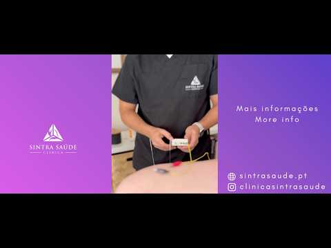 Acupuncture in Sintra