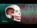 Bruxism (Clenching and Grinding)