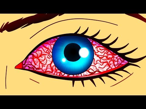 Evinizde Zehirli Küf Bulunduğunun 9 İşareti