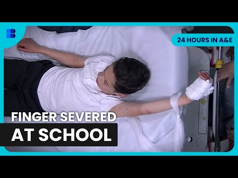 Boy Severs Finger on School Fence Emergency Surgery | 24 Hours in A&E