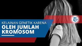 Down Syndrome,  Kelainan Genetik Disebabkan oleh Jumlah Kromosom 21 yang Berlebihan