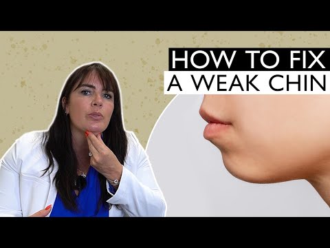 How To Fix A Weak Chin Non-Surgically