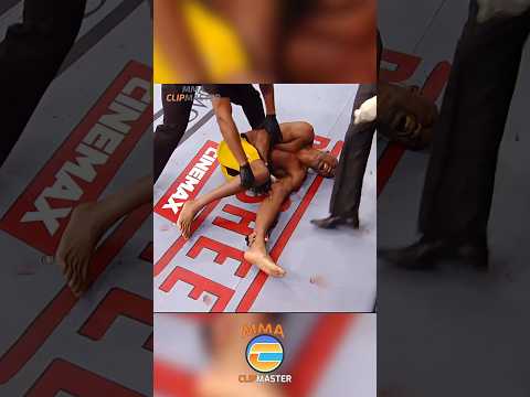Anderson Silva Suffered The WORST HORROR INJURY in MMA History
