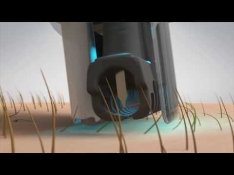 no!no! ULTRA - how it works to remove hair