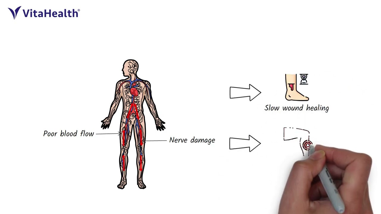 Do You Often Feel Tired, Thirsty, Or Hungry All The Time Even After Eating?
