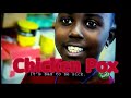 PBSKids Chicken Pox Brain And Agent Olympia