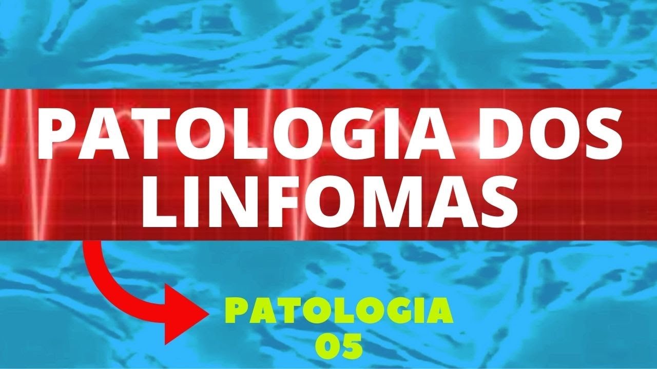 PATOLOGIA DOS LINFOMAS - O QUE SÃO, DIAGNÓSTICO E TRATAMENTO