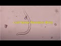Live Human Parasite In Stool Microscopy