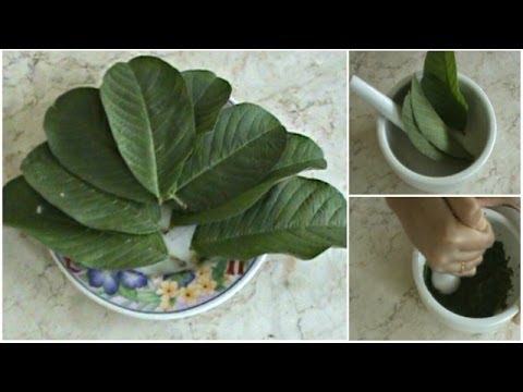 download lagu mp3 mp4 Cara Menghilangkan Jerawat Herbal, download lagu Cara Menghilangkan Jerawat Herbal gratis, unduh video klip Cara Menghilangkan Jerawat Herbal