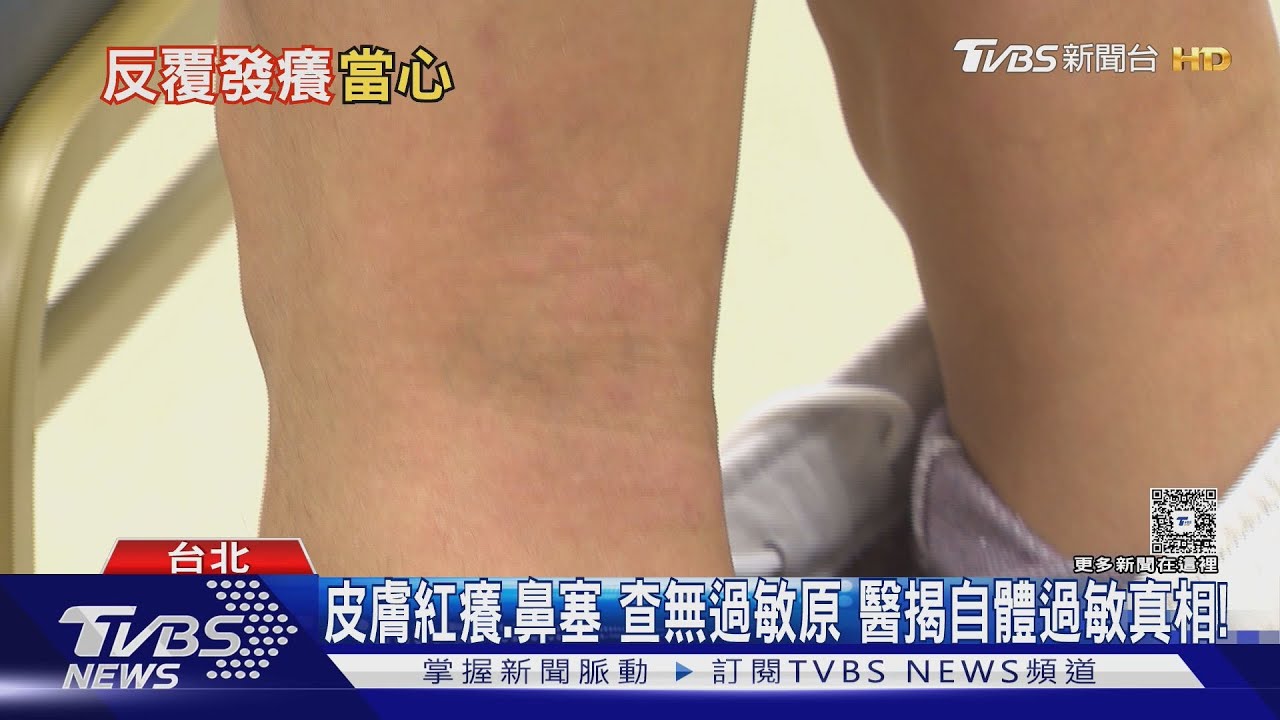 過敏檢測都正常!卻一直癢又鼻塞?醫師:可能是「這棘手問題」頻作怪!