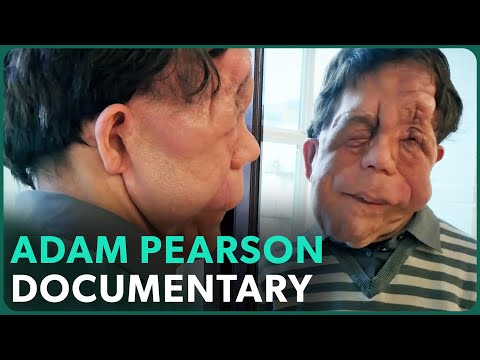 The Ugly Face of Disability Hate Crime (Adam Pearson Documentary) | Real Stories