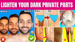 Lighten Your Dark Body Parts Naturally | Private Parts Whitening, Neck, Underarms | Get Clear Skin