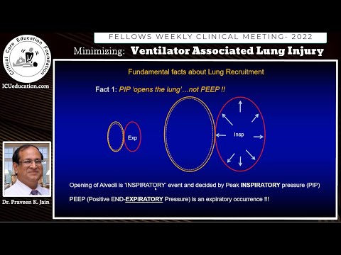 Preventing Ventilator Associated Lung Injury