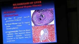Dr.Sahar - Parasitic infections (2) - Pathology