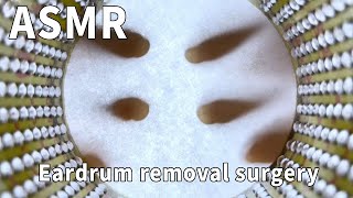 Eardrum removal from the eardrum's perspective. Sleep aid scenario simulation #assist #asmr