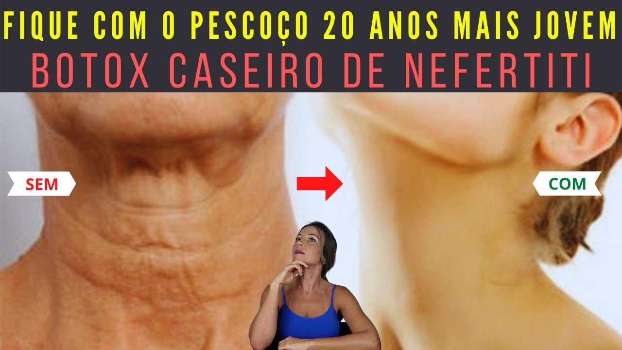 Como Ficar com o PESCOÇO 20 ANOS + JOVEM - Botox Caseiro ELIMINA PAPADA, FLACIDEZ e RUGAS do COLAR