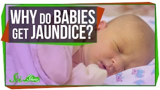 Why Do Newborn Babies Get Jaundice?