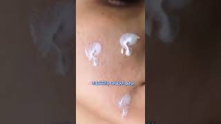 BIOXCIN ATOPICARE Clinical Nourishing Face Cream 50ml - Video