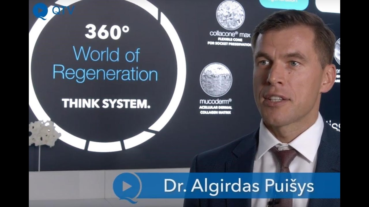 Peri-implant soft tissue augmentation for long-term success with implants