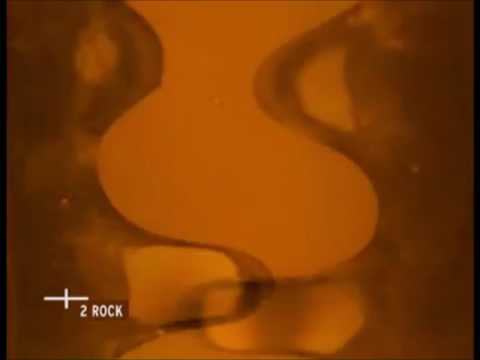 [ARCHIVE] Viva Zwei Clips Collection 5