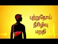 Stalin S Campaign Releases Anti Alcohol Video To Hold Medical Consultation On Health Impacts