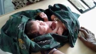 Newly born baby with open heart... In karnataka