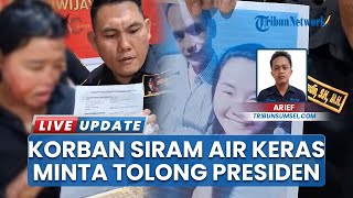 Minta Hapuskan Utang Biaya Berobat di RSMHP, Suryani Korban Siram Air Keras Surati Presiden