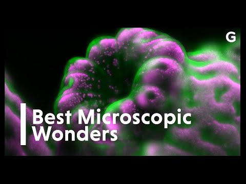 The World's Best Microscopic Wonders | Nikon Small World in Motion Contest