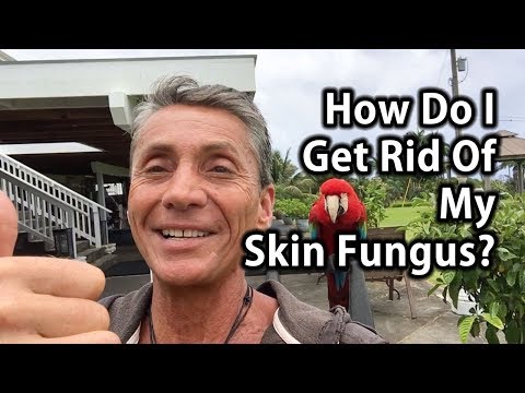 Kung sino upang makipag-ugnay sa kuko halamang-singaw Ang pinaka-popular na gamot para sa fungus