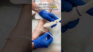 Download lagu Is Ablation and Venaseal Treatment for Varicose Veins is Safe? mp3