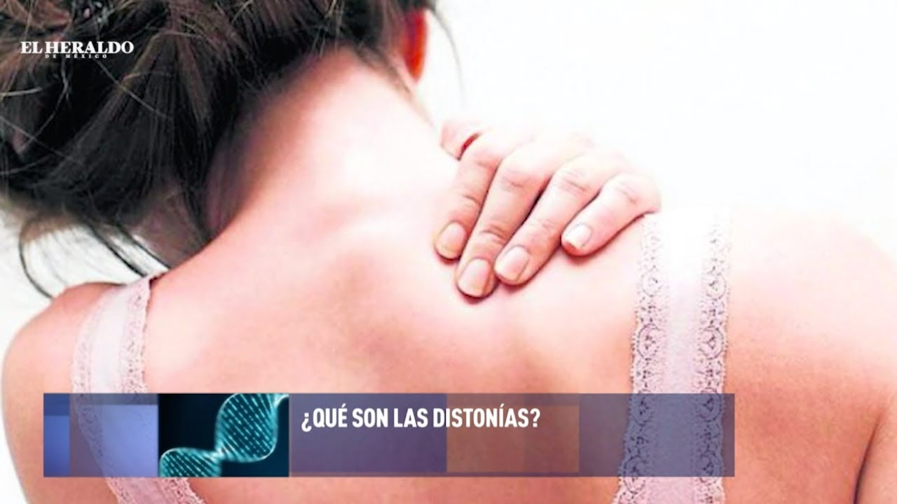 ¿Qué es la distonía y cómo se puede tratar?