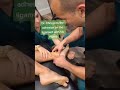 Got Chronic Ankle Sprains And A Pinch In The Front Of The Ankle Meet Your Posterior Tibiotalar Lig
