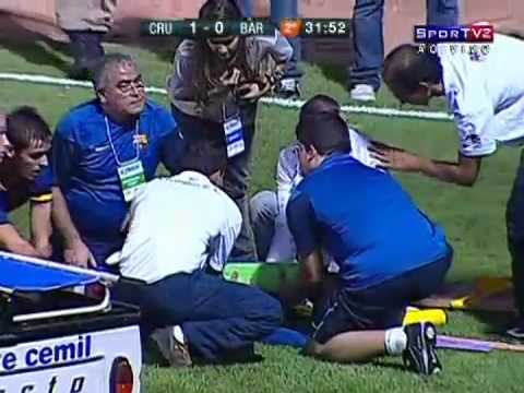 Fratura do Jogador do Barcelona  (barcelona player breaks his ankle)