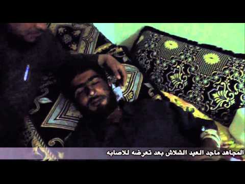 اصابة ماجد العيد الشلاش أحد عناصر كتائب أحفاد عائشة في ريف دير الزور